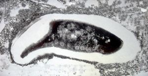 Nosema - brain, rabbit Nosema - brain, rabbit